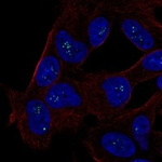 ALX3 Antibody in Immunocytochemistry (ICC/IF)