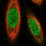 PRDM14 Polyclonal Antibody