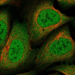 NCoR1 Antibody in Immunocytochemistry (ICC/IF)