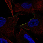 alpha-1b Adrenergic Receptor Antibody in Immunocytochemistry (ICC/IF)
