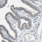 CD266 Antibody in Immunohistochemistry (Paraffin) (IHC (P))