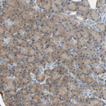 CD266 Antibody in Immunohistochemistry (Paraffin) (IHC (P))