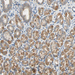 CD266 Antibody in Immunohistochemistry (Paraffin) (IHC (P))