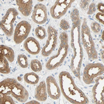 CD266 Antibody in Immunohistochemistry (Paraffin) (IHC (P))