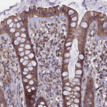 HUNK Antibody in Immunohistochemistry (Paraffin) (IHC (P))