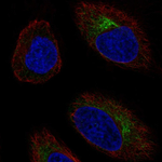 CCR10 Antibody in Immunocytochemistry (ICC/IF)