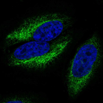 CCR10 Polyclonal Antibody