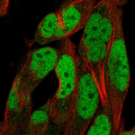 ADAMTS5 Antibody in Immunocytochemistry (ICC/IF)