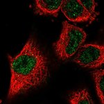 LOXL2 Polyclonal Antibody