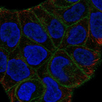 SLITRK6 Polyclonal Antibody