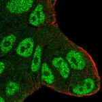 Ataxin 1 Antibody in Immunocytochemistry (ICC/IF)