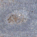 Complement C9 Antibody in Immunohistochemistry (Paraffin) (IHC (P))