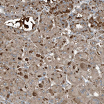 Complement C9 Antibody in Immunohistochemistry (Paraffin) (IHC (P))