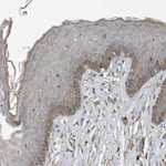 Complement C9 Antibody in Immunohistochemistry (Paraffin) (IHC (P))