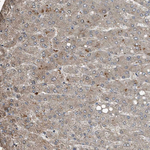 Complement C9 Antibody in Immunohistochemistry (Paraffin) (IHC (P))