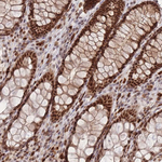 SMAD9 Antibody in Immunohistochemistry (Paraffin) (IHC (P))