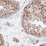 SMAD9 Antibody in Immunohistochemistry (Paraffin) (IHC (P))