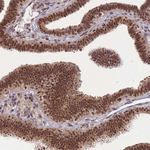 SMAD9 Antibody in Immunohistochemistry (Paraffin) (IHC (P))