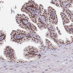 SMAD9 Antibody in Immunohistochemistry (Paraffin) (IHC (P))