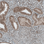 SENP1 Antibody in Immunohistochemistry (Paraffin) (IHC (P))