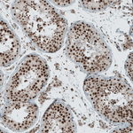 SENP1 Antibody in Immunohistochemistry (Paraffin) (IHC (P))
