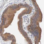 VAV2 Antibody in Immunohistochemistry (Paraffin) (IHC (P))