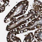 FZD10 Antibody in Immunohistochemistry (Paraffin) (IHC (P))