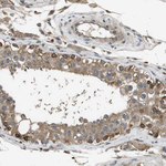 FZD10 Antibody in Immunohistochemistry (Paraffin) (IHC (P))