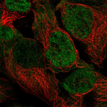 PSMD3 Polyclonal Antibody