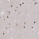 PSMD3 Antibody in Immunohistochemistry (Paraffin) (IHC (P))