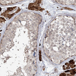 CARD6 Antibody in Immunohistochemistry (Paraffin) (IHC (P))