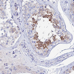Securin Antibody in Immunohistochemistry (Paraffin) (IHC (P))