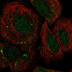 FosB Antibody in Immunocytochemistry (ICC/IF)