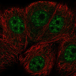 ERCC8 Polyclonal Antibody