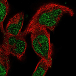 SMNDC1 Antibody in Immunocytochemistry (ICC/IF)