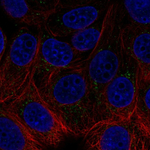 Acetylcholinesterase Polyclonal Antibody