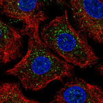 beta-Arrestin 2 Antibody in Immunocytochemistry (ICC/IF)