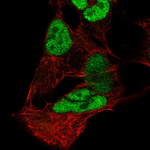 PAX3 Polyclonal Antibody