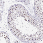 PAX3 Antibody in Immunohistochemistry (Paraffin) (IHC (P))