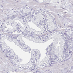 PAX3 Antibody in Immunohistochemistry (Paraffin) (IHC (P))