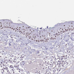 PAX3 Antibody in Immunohistochemistry (Paraffin) (IHC (P))