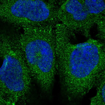 Fe65 Polyclonal Antibody