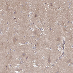 Fe65 Antibody in Immunohistochemistry (Paraffin) (IHC (P))