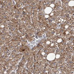 Tankyrase Antibody in Immunohistochemistry (Paraffin) (IHC (P))