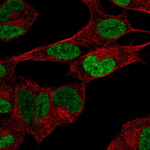 PHOX2B Polyclonal Antibody