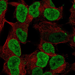 PHOX2B Antibody in Immunocytochemistry (ICC/IF)