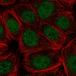 Cdc73 Antibody in Immunocytochemistry (ICC/IF)