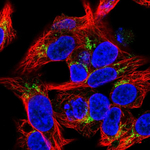 Endostatin Polyclonal Antibody