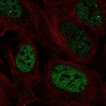 PAX3 Polyclonal Antibody