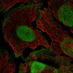 XPC Polyclonal Antibody